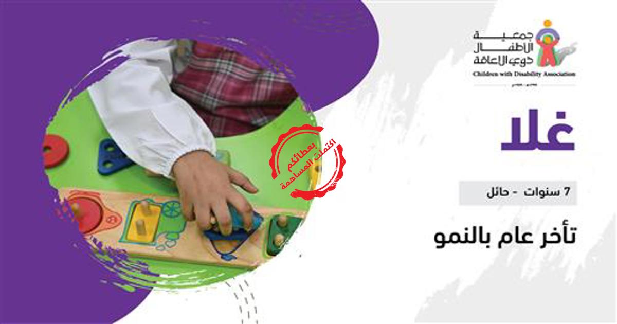 حلم غلا